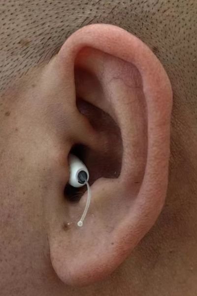 Ceretone Core One in myleft ear
