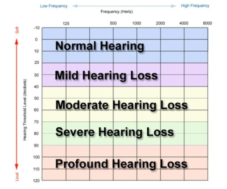 hearing loss level